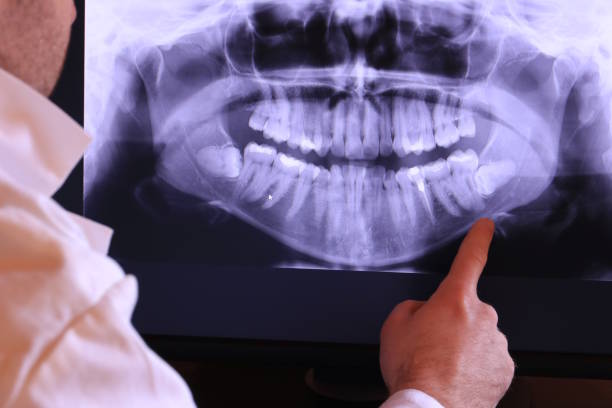 Best Pediatric Emergency Dentist in Hillsdale, MI
