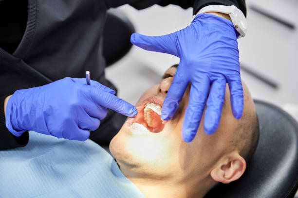 Best Emergency Wisdom Teeth Removal in Hillsdale, MI